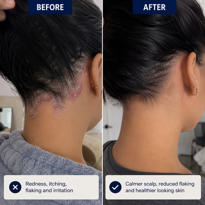 Copper Peptide Hair Serum