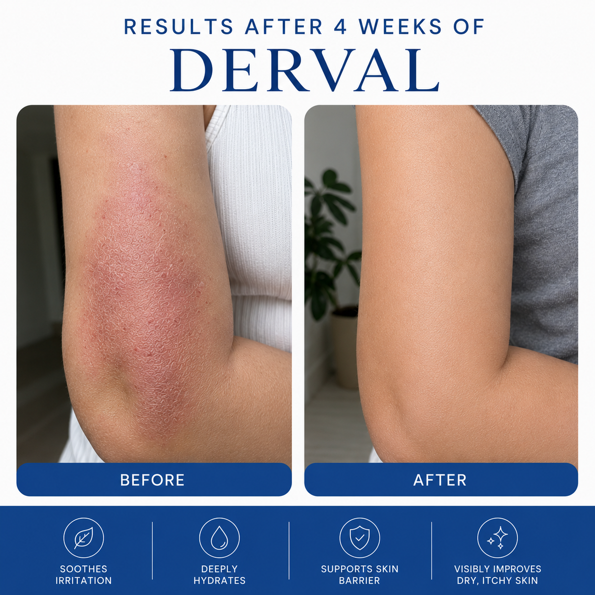 Psoriasis & Eczema Relief Cream