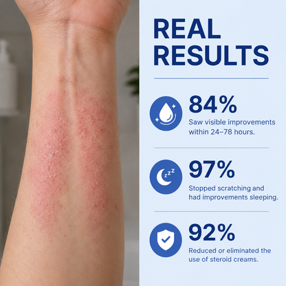 Psoriasis & Eczema Relief Cream