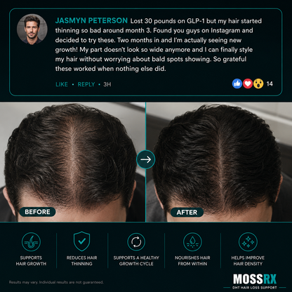 DHT Hair Loss Gummies