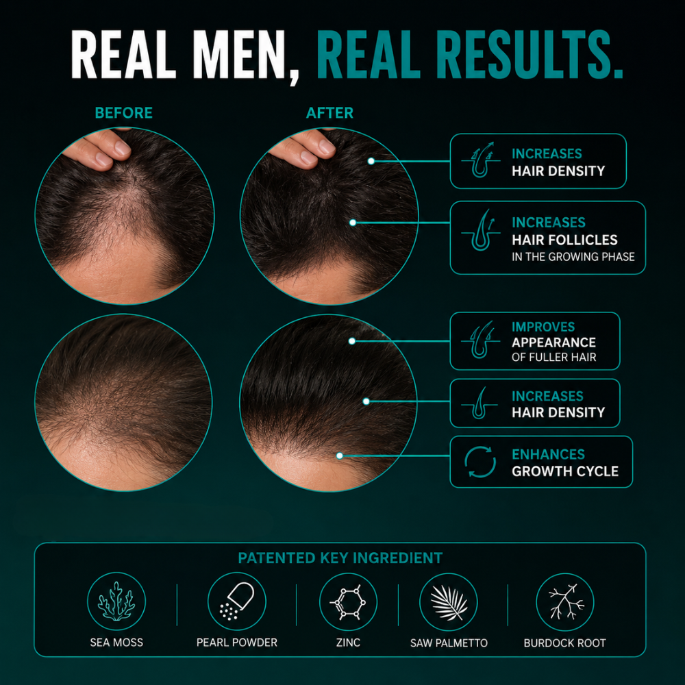 DHT Hair Loss Gummies